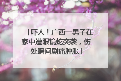 吓人！广西一男子在家中遭眼镜蛇突袭，伤处瞬间剧痛肿胀
